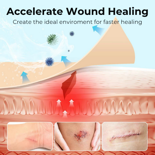 Hydrocolloid Roll - Healing Technology