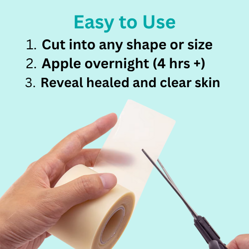 Hydrocolloid Roll - Healing Technology