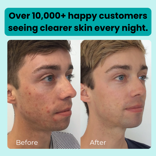 Hydrocolloid Roll - Healing Technology